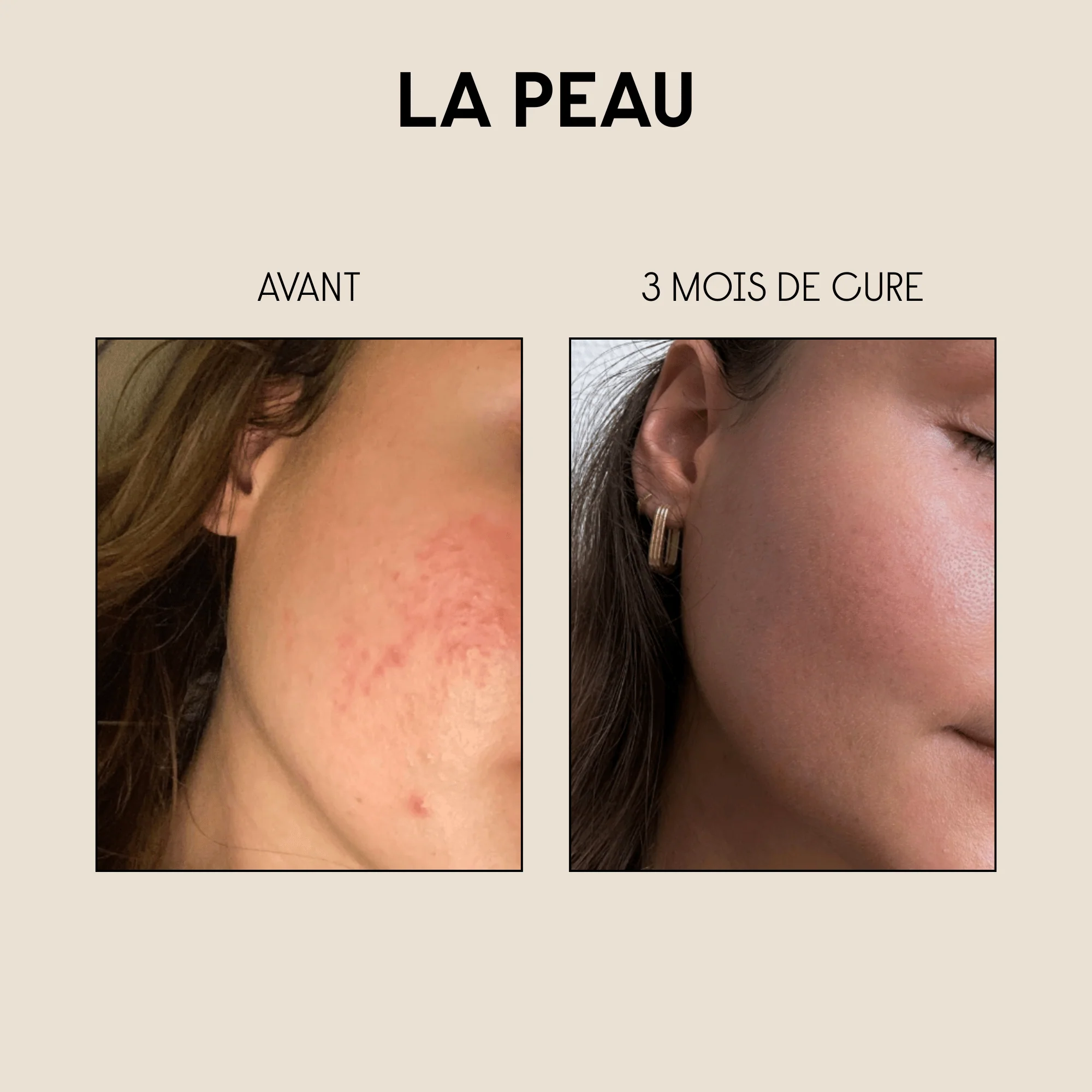 Rituel Cheveux & Peau - Image 8
