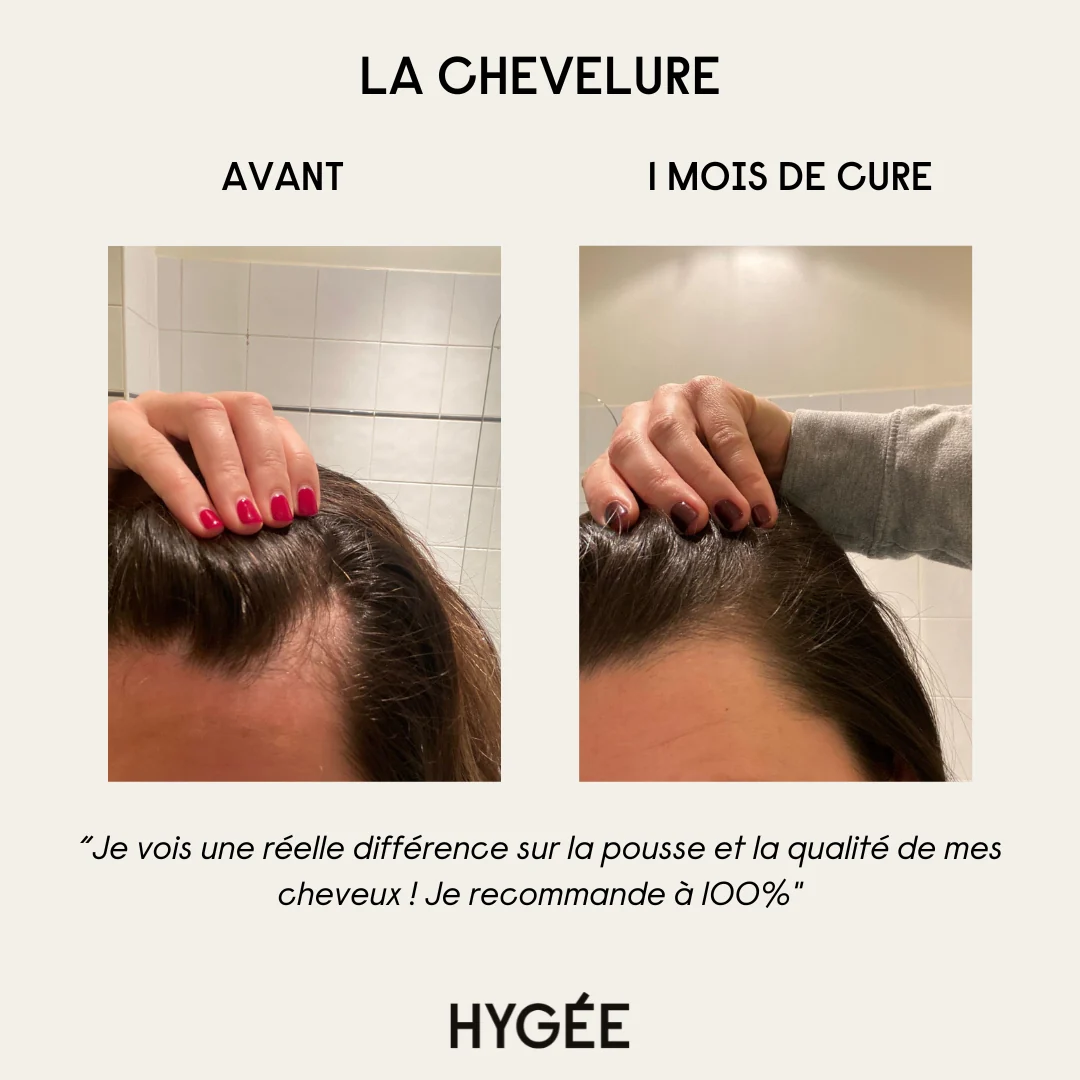 Chevelure-bestseller - Image 3
